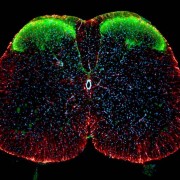 Marcello-Costa---spinal_cord_1.b