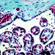 Rachel Burgess_Placental Tissue