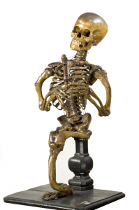 Figure 6: Harry Brookes Allen Museum of Anatomy and Pathology, Melbourne. Reproduced with permission.